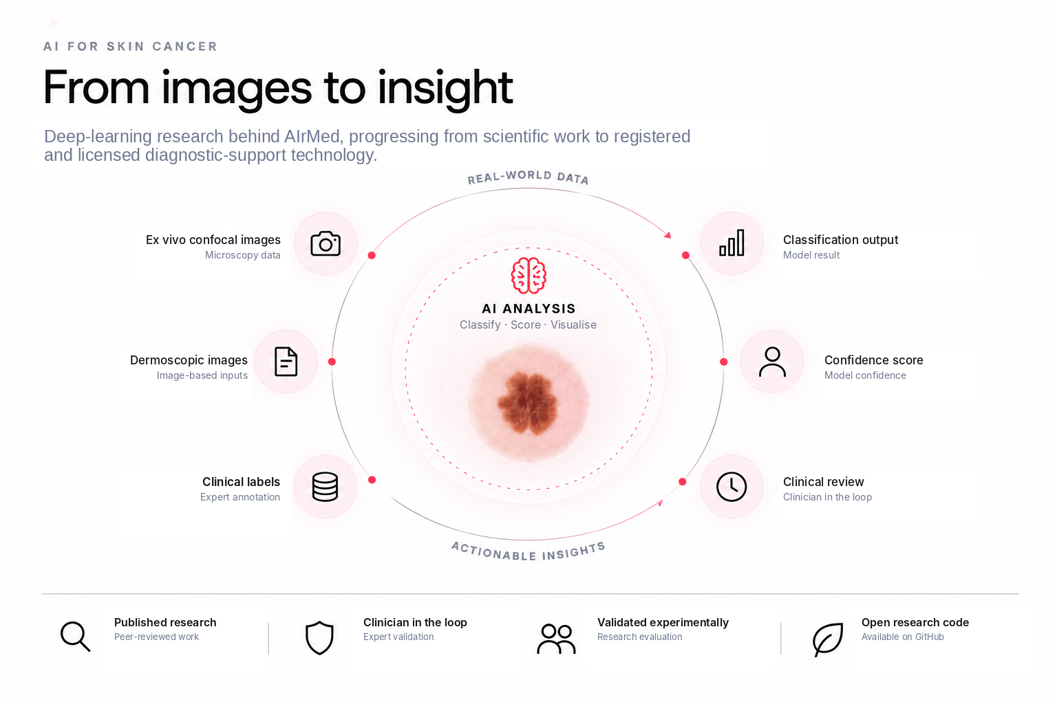 AI for Skin Cancer — AIrMed research progressing from scientific work to registered and licensed diagnostic-support technology.